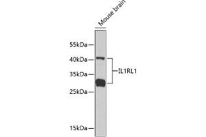 Western blot analysis of extracts of mouse brain, using IL1RL1 antibody . (IL1RL1 anticorps  (AA 19-328))