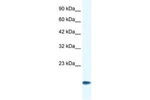 Western Blotting (WB) image for anti-Cysteine and Glycine-Rich Protein 3 (CSRP3) antibody (ABIN2460883) (CSRP3 anticorps)