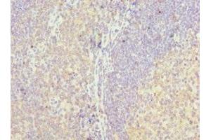 Immunohistochemistry of paraffin-embedded human tonsil tissue using ABIN7158640 at dilution of 1:100 (LY86 anticorps  (AA 21-162))