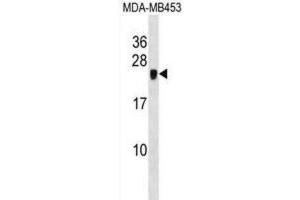 Western Blotting (WB) image for anti-Cysteine-Rich Protein 2 (CRIP2) antibody (ABIN2998781) (CRIP2 anticorps)