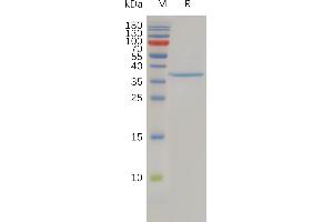 Human C Protein, hFc Tag on SDS-PAGE under reducing condition.