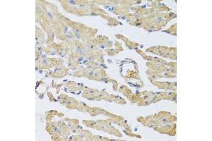 Immunohistochemistry of paraffin-embedded mouse heart using UCN2 antibody at dilution of 1:100 (40x lens). (Urocortin 2 anticorps)