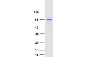 Validation with Western Blot