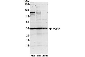 Western Blotting (WB) image for anti-Nitric Oxide Synthase Interacting Protein (NOSIP) (AA 100-150) antibody (ABIN7453001)