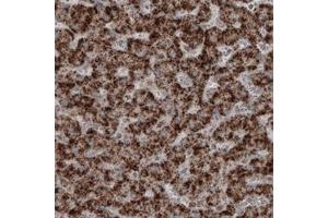 Immunohistochemical staining (Formalin-fixed paraffin-embedded sections) of human liver with ACAA1 monoclonal antibody, clone CL2660  shows strong granular cytoplasmic positivity in hepatocytes.