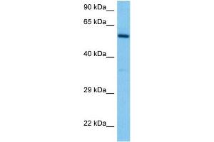 Host:  Mouse  Target Name:  DAB2  Sample Tissue:  Mouse Spleen  Antibody Dilution:  1ug/ml (DAB2 anticorps  (N-Term))
