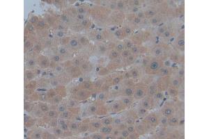 Used in DAB staining on fromalin fixed paraffin- embedded Kidney tissue