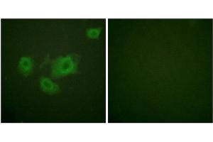 Immunofluorescence analysis of HuvEc cells, using Kir6. (KCNJ11 anticorps  (pThr224))