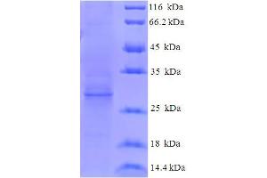 SDS-PAGE (SDS) image for Hepatitis E Virus ORF3 (HEV ORF3) (AA 1-114), (full length) protein (His-SUMO Tag) (ABIN5711211)