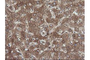 Image no. 1 for anti-Cancer/testis Antigen 1B (CTAG1B) antibody (ABIN1499896) (CTAG1B anticorps)