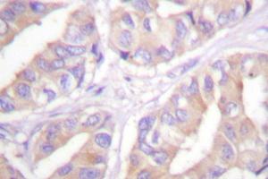 Image no. 2 for anti-V-Raf Murine Sarcoma 3611 Viral Oncogene Homolog (ARAF) antibody (ABIN271994) (ARAF anticorps)