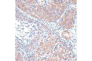 Immunohistochemistry of paraffin-embedded Rat ovary using TIMP2 antibody (ABIN7268483) at dilution of 1:100 (40x lens). (TIMP2 anticorps  (AA 100-200))