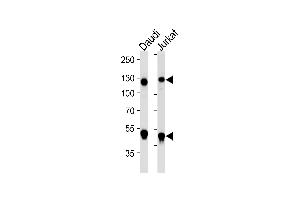 Western blot analysis of lysates from Daudi, Jurkat cell line (from left to right), using NFKB1 Antibody (ABIN1882050 and ABIN2843642).