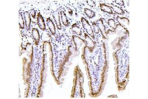 IHC analysis of PTBP1 using anti-PTBP1 antibody (ABIN7599450). (PTBP1 anticorps  (AA 1-504))