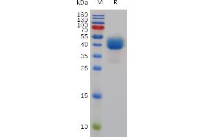 Mouse TIGIT Protein, hFc Tag on SDS-PAGE under reducing condition.