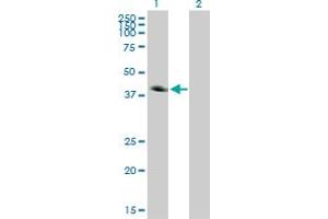 Western Blot analysis of CA12 expression in transfected 293T cell line by CA12 monoclonal antibody (M01), clone 1D4. (CA12 anticorps  (AA 25-124))