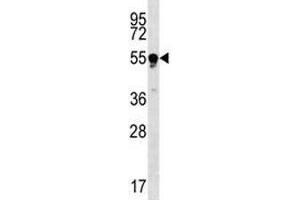 TUBB4Q antibody western blot analysis in Jurkat lysate. (TUBB4Q anticorps  (AA 64-93))