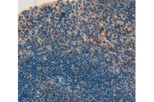 IHC-P analysis of Human Tissue, with DAB staining. (CD226 anticorps  (AA 19-254))