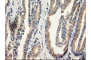 Image no. 3 for anti-Catalase (CAT) antibody (ABIN1497109)