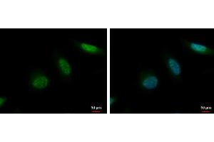 ICC/IF Image MCAK antibody [N1N3] detects MCAK protein at nucleus by immunofluorescent analysis. (KIF2C anticorps)