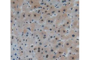 IHC-P analysis of Human Tissue, with DAB staining. (KLF5 anticorps  (AA 216-457))