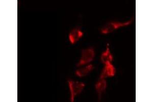 ABIN6274740 staining COLO205 by IF/ICC. (MRPL40 anticorps  (C-Term))