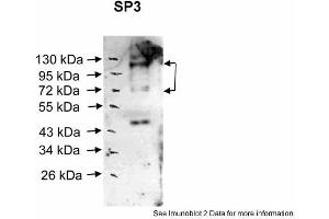 Sample Type: Human nuclear cell extracts (30ug)Primary Dilution: 1:1000Secondary Antibody: anti-Rabbit HRPSecondary Dilution: 1:20000Image Submitted By:  Katarina LuciakovaCancer Research Institute . (Sp3 anticorps  (Middle Region))