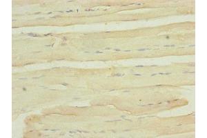 Immunohistochemistry of paraffin-embedded human skeletal muscle tissue using ABIN7174957 at dilution of 1:100 (MYO5B anticorps  (AA 1440-1690))