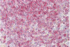 Immunohistochemistry with Spleen tissue at an antibody concentration of 5µg/ml using anti-RIPK3 antibody (AVARP00031_P050) (RIPK3 anticorps  (Middle Region))