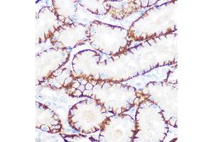 Immunohistochemistry of paraffin-embedded rat kidney using NDRG1 Rabbit mAb (ABIN7268783) at dilution of 1:100 (40x lens).