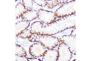 Immunohistochemistry of paraffin-embedded rat kidney using NDRG1 Rabbit mAb (ABIN7268783) at dilution of 1:100 (40x lens). (NDRG1 anticorps)