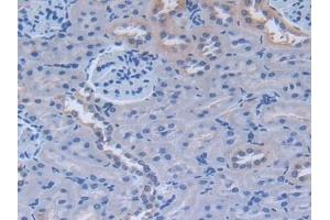 Detection of FN in Rat Kidney Tissue using Polyclonal Antibody to Fibronectin (FN)