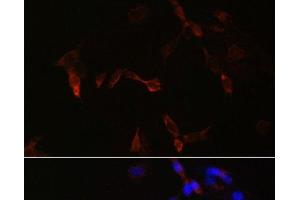 Immunofluorescence analysis of NIH/3T3 cells using PLA2G5 Polyclonal Antibody at dilution of 1:100. (PLA2G5 anticorps)
