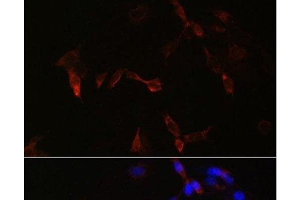 PLA2G5 anticorps