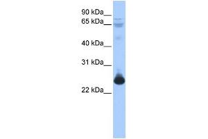 WB Suggested Anti-TCEAL1 Antibody Titration:  0. (TCEAL1 anticorps  (Middle Region))