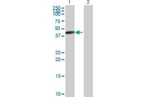 Western Blot analysis of CPB1 expression in transfected 293T cell line by CPB1 MaxPab rabbit polyclonal antibody. (CPB1 anticorps  (AA 1-417))