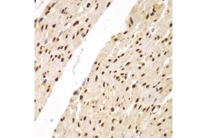 Immunohistochemistry of paraffin-embedded human colon using SUPT20H antibody (ABIN5975125) at dilution of 1/100 (40x lens). (FAM48A/P38IP anticorps)