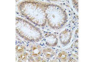 Immunohistochemistry of paraffin-embedded human stomach using CPM antibody (ABIN6128978, ABIN6138956, ABIN6138957 and ABIN6222238) at dilution of 1:100 (40x lens).