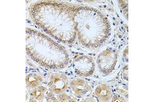Immunohistochemistry of paraffin-embedded human stomach using CPM antibody (ABIN6128978, ABIN6138956, ABIN6138957 and ABIN6222238) at dilution of 1:100 (40x lens). (CPM anticorps  (AA 204-443))