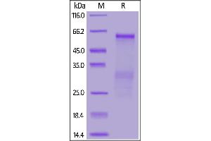 SARS Nucleocapsid protein, His Tag on  under reducing (R) condition.