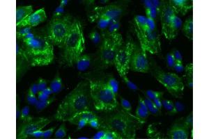 Immunofluorescent staining of SK-N-SH cells.