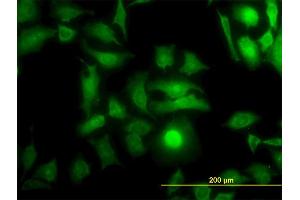 Immunofluorescence of monoclonal antibody to DOCK4 on HeLa cell. (DOCK4 anticorps  (AA 1867-1966))