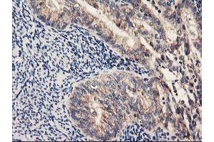 Image no. 1 for anti-Prenyl (Decaprenyl) Diphosphate Synthase, Subunit 2 (PDSS2) antibody (ABIN1500138)