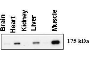 Image no. 1 for anti-Amylo-alpha-1, 6-Glucosidase, 4-alpha-Glucanotransferase (AGL) (AA 1487-1516), (C-Term) antibody (ABIN357688) (AGL anticorps  (C-Term))