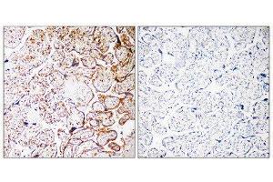 Immunohistochemistry (IHC) image for anti-Coiled-Coil Domain Containing 102B (CCDC102B) (Internal Region) antibody (ABIN1851142) (CCDC102B anticorps  (Internal Region))