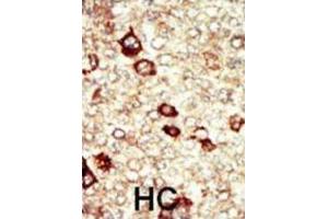 Immunohistochemistry (IHC) image for anti-Fibroblast Growth Factor Receptor 4 (FGFR4) antibody (ABIN3003375) (FGFR4 anticorps)