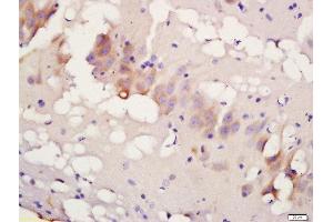 Formalin-fixed and paraffin embedded rat brain labeled with Rabbit Anti-TBK1 (Ser172) Polyclonal Antibody, Unconjugated 1:200 followed by conjugation to the secondary antibody and DAB staining (TBK1 anticorps  (pSer172))