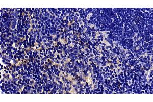 Detection of CAV1 in Mouse Spleen Tissue using Polyclonal Antibody to Caveolin 1 (CAV1)