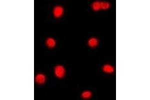 Immunofluorescent analysis of C/EBP gamma staining in Jurkat cells. (CEBPG anticorps)