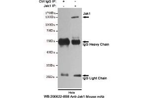 Immunoprecipitation analysis of Hela cell lysates using Jak1 mouse mAb. (JAK1 anticorps)